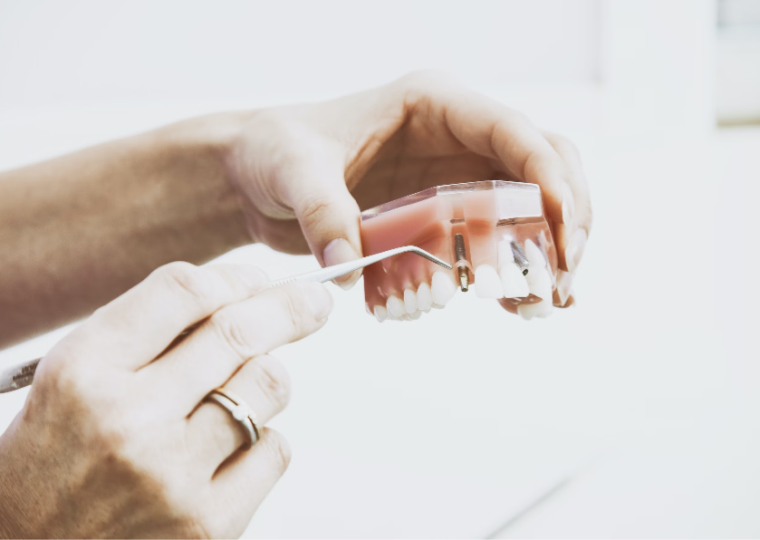 tandartsenpraktijk beukenlei tandtrauma